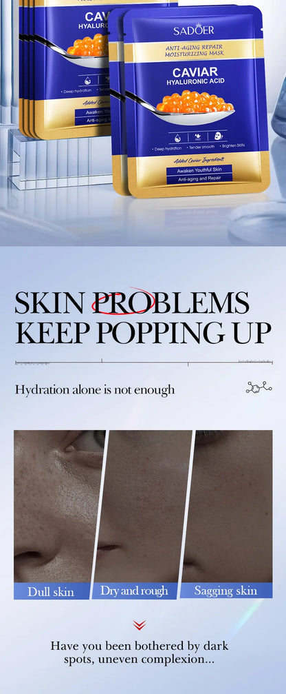 5pcs SADOER Caviar Hyaluronic Acid Moisturizing Facial Masks Brightening Firming Hydrating Face Mask Facial Skin Care Products