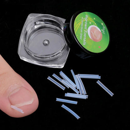 1-10 Box Elastic C-shaped Tube Padding Treatment Foot Care Invisible Groove Straightening Clip Ingrown Toenail Corrector Tools