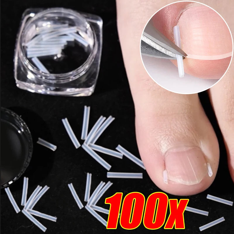 1-10 Box Elastic C-shaped Tube Padding Treatment Foot Care Invisible Groove Straightening Clip Ingrown Toenail Corrector Tools