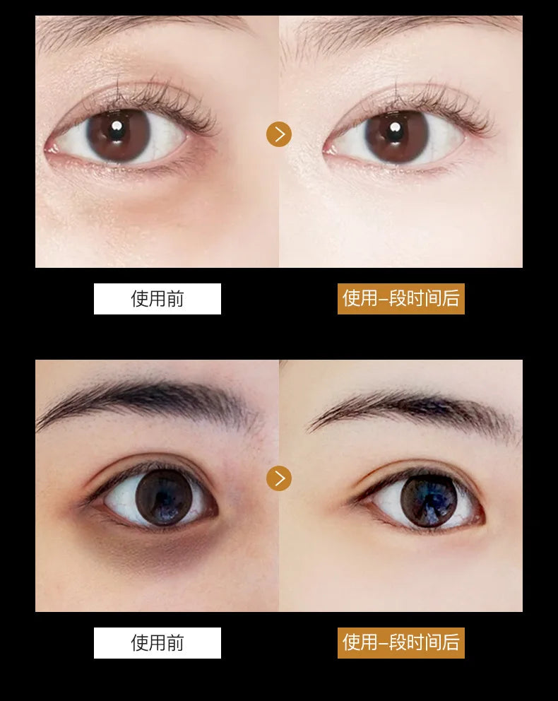 Skincare Products 24K Gold Hyaluronic Acid Eye Mask Remove Dark Eye Circles Collagen Eye Patches Korean Face Care Product