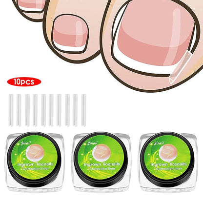 1-10 Box Elastic C-shaped Tube Padding Treatment Foot Care Invisible Groove Straightening Clip Ingrown Toenail Corrector Tools