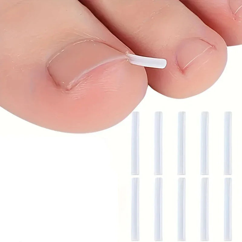 1-10 Box Elastic C-shaped Tube Padding Treatment Foot Care Invisible Groove Straightening Clip Ingrown Toenail Corrector Tools
