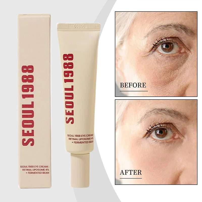Seoul 1988 Retinol Eye Cream 4% Anti Aging Eye Treatment Dark Circles, Wrinkles, Puffiness Firming & Lifting Eye Cream For Women